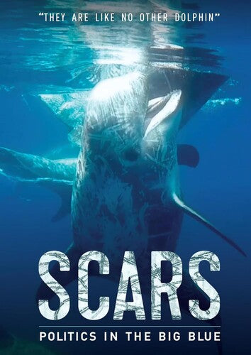 Scars