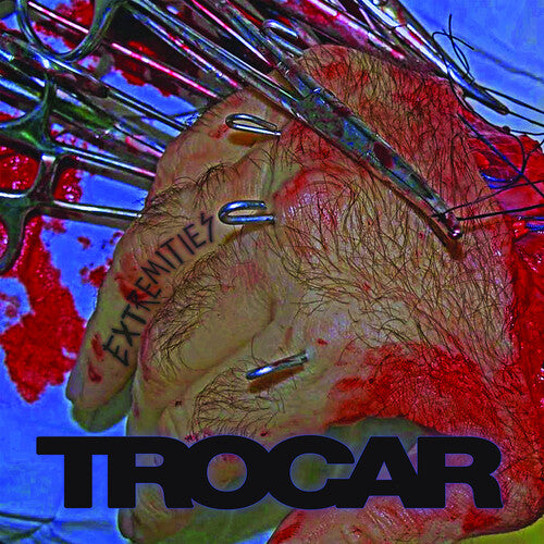 Trocar - Extremities