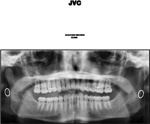 Jack Cleaf - Jvc
