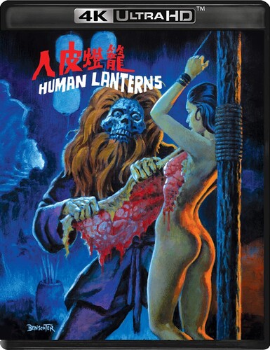 Human Lanterns