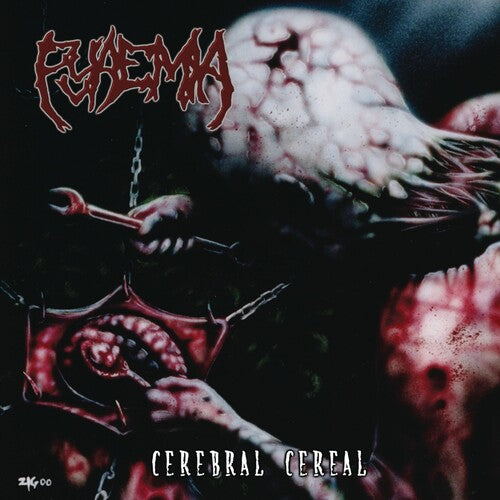 Pyaemia - Cerebral Cereal