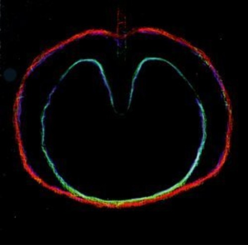 Xtc - Wasp Star: Apple Venus 2