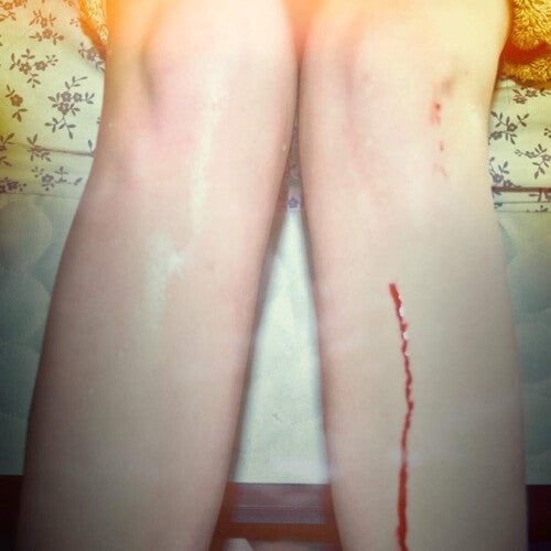 Campesinos - Romance Is Boring (10th Anniversary)