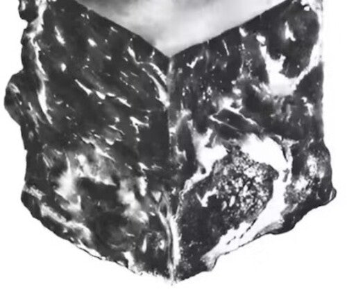 Against Me - Transgender Dysphoria Blues [10th Anniversary Edition]