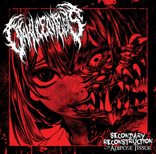 Otakucentesis - Secondary Reconstruction Of Adipose Tissue