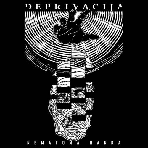 Deprivacija - Nematoma Ranka