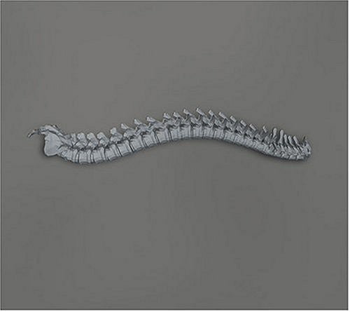 Kill Memory Crash - When the Blood Turns Black